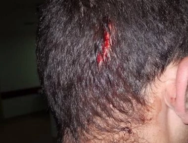 Από θαύμα σώθηκαν οι αστυνομικοί από τους Ρομά: Δεν λειτουργούσε ο ασύρματος & ειδοποίησαν με το κινητό!